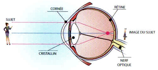 Schéma de la myopie